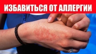 Аллергия На Коже. Симптомы Лечение Профилактика
